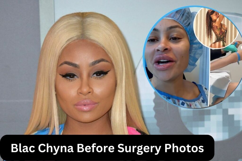 Blac Chyna Before Surgery Photos Shocking Body Transformation