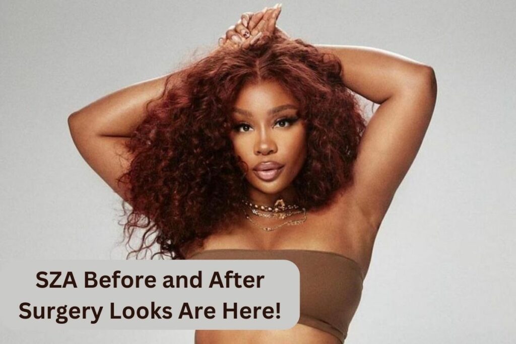 SZA Before and After Surgery Looks Are Here!