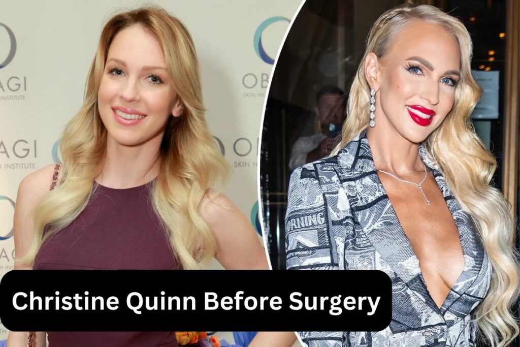 Christine Quinn Before Surgery Before and After Transformation!