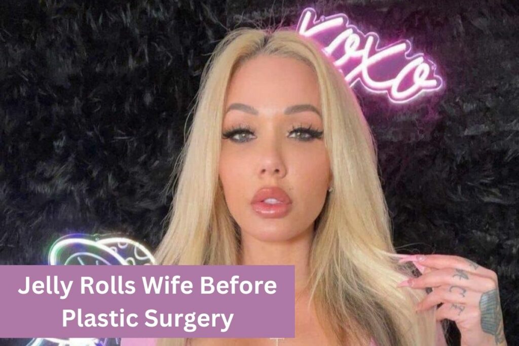 Jelly Rolls Wife Before Plastic Surgery Her Transformation Revealed!