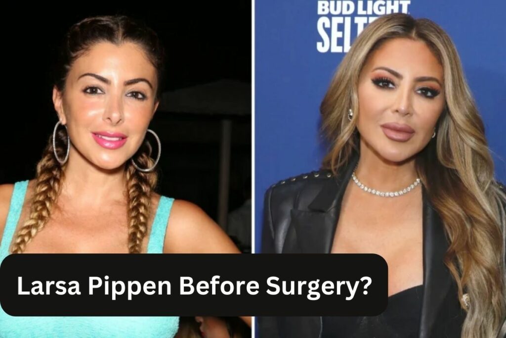 Larsa Pippen Before Surgery Before and After Transformation!