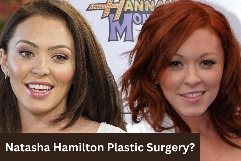 Natasha Hamilton Plastic Surgery Her Transformation Journey!